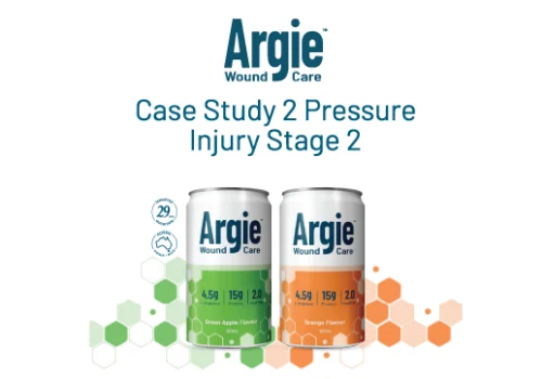 Argie Wound Care – Case Study 2 – Pressure Injury Thumbnail