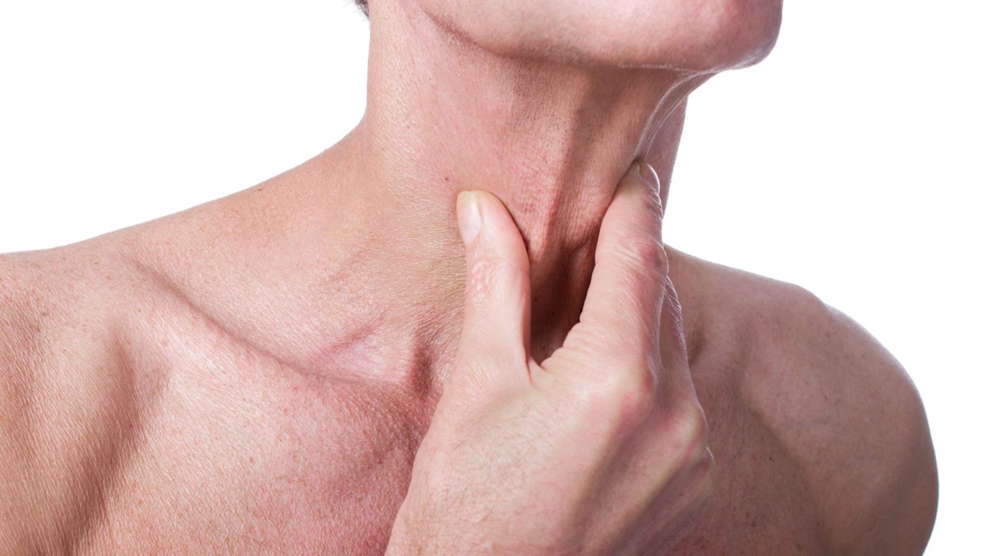 Senior,Man,With,Throat,Or,Neck,Irritation